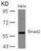 SMAD2 antibody, AP08072PU-S, Origene, Western Blot image 