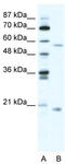 Zinc Finger Protein 18 antibody, TA333510, Origene, Western Blot image 