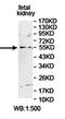 Coagulation Factor X antibody, orb78369, Biorbyt, Western Blot image 