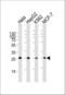 Phosphomannomutase 2 antibody, LS-C158686, Lifespan Biosciences, Western Blot image 