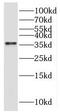 Gamma-sarcoglycan antibody, FNab07803, FineTest, Western Blot image 