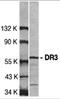 TNF Receptor Superfamily Member 25 antibody, 1120, ProSci, Western Blot image 