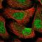 Coiled-Coil And C2 Domain Containing 1B antibody, NBP2-58794, Novus Biologicals, Immunofluorescence image 