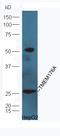 Transmembrane Protein 176A antibody, orb158621, Biorbyt, Western Blot image 