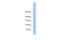 Zinc Finger HIT-Type Containing 3 antibody, 26-539, ProSci, Western Blot image 