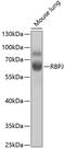 Recombination Signal Binding Protein For Immunoglobulin Kappa J Region antibody, 19-786, ProSci, Western Blot image 