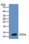 Natriuretic Peptide B antibody, LS-C698564, Lifespan Biosciences, Western Blot image 