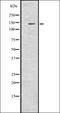 Sal-like protein 4 antibody, orb336813, Biorbyt, Western Blot image 