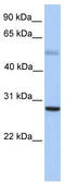 MAX Dimerization Protein 1 antibody, TA335839, Origene, Western Blot image 