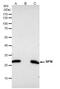 14-3-3 sigma antibody, PA5-34644, Invitrogen Antibodies, Immunoprecipitation image 