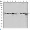 Chaperonin Containing TCP1 Subunit 2 antibody, LS-C814037, Lifespan Biosciences, Western Blot image 