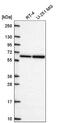 Cytoplasmic polyadenylation element-binding protein 2 antibody, NBP2-56392, Novus Biologicals, Western Blot image 