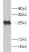 P09211 antibody, FNab03699, FineTest, Western Blot image 