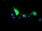 Dolichyl-diphosphooligosaccharide--protein glycosyltransferase subunit 1 antibody, TA503652, Origene, Immunofluorescence image 