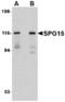 Zinc Finger FYVE-Type Containing 26 antibody, LS-B3873, Lifespan Biosciences, Western Blot image 