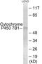Cytochrome P450 Family 7 Subfamily B Member 1 antibody, EKC1922, Boster Biological Technology, Western Blot image 