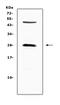 Cytotoxic T-Lymphocyte Associated Protein 4 antibody, A00020-1, Boster Biological Technology, Western Blot image 
