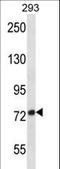 ADAM Metallopeptidase Domain 32 antibody, LS-C156045, Lifespan Biosciences, Western Blot image 