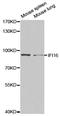 Gamma-interferon-inducible protein 16 antibody, LS-C331821, Lifespan Biosciences, Western Blot image 