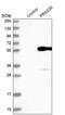 Serine Protease 35 antibody, PA5-58541, Invitrogen Antibodies, Western Blot image 