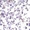 PD-L1 antibody, SD8639, ProSci Inc, Immunocytochemistry image 