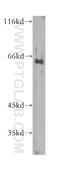 General Transcription Factor IIH Subunit 1 antibody, 10173-1-AP, Proteintech Group, Western Blot image 