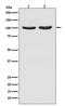 Androgen Receptor antibody, M00542-1, Boster Biological Technology, Western Blot image 
