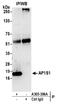 AP-1 complex subunit sigma-1A antibody, A305-396A, Bethyl Labs, Immunoprecipitation image 