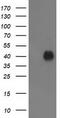 Pyridoxal kinase antibody, CF503031, Origene, Western Blot image 