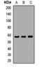 Cholinergic Receptor Nicotinic Gamma Subunit antibody, orb412665, Biorbyt, Western Blot image 