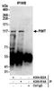 Protein-L-Isoaspartate (D-Aspartate) O-Methyltransferase antibody, A304-922A, Bethyl Labs, Immunoprecipitation image 