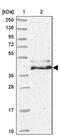 Hydroxymethylbilane Synthase antibody, PA5-62230, Invitrogen Antibodies, Western Blot image 