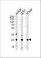 Glutathione S-Transferase Mu 1 antibody, A00569, Boster Biological Technology, Western Blot image 