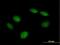 PHD Finger Protein 21B antibody, H00112885-B01P, Novus Biologicals, Immunocytochemistry image 