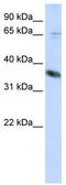 ST6 N-Acetylgalactosaminide Alpha-2,6-Sialyltransferase 1 antibody, TA342377, Origene, Western Blot image 