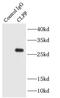 Caseinolytic Mitochondrial Matrix Peptidase Proteolytic Subunit antibody, FNab01772, FineTest, Immunoprecipitation image 