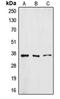 ZFP36 Ring Finger Protein Like 1 antibody, orb213616, Biorbyt, Western Blot image 