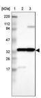 Amyloid Beta Precursor Protein Binding Family B Member 3 antibody, NBP1-84699, Novus Biologicals, Western Blot image 