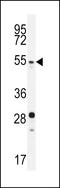 Lysine Methyltransferase 5C antibody, LS-C161630, Lifespan Biosciences, Western Blot image 