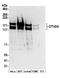 OTU Deubiquitinase 4 antibody, A304-605A, Bethyl Labs, Western Blot image 