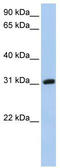 Dickkopf Like Acrosomal Protein 1 antibody, TA335625, Origene, Western Blot image 