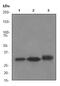 NAD(P)H Quinone Dehydrogenase 1 antibody, ab80588, Abcam, Western Blot image 