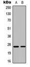 Cytidine/Uridine Monophosphate Kinase 1 antibody, LS-C358946, Lifespan Biosciences, Western Blot image 