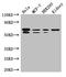 Recombining binding protein suppressor of hairless antibody, LS-C679300, Lifespan Biosciences, Western Blot image 