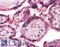 Endoplasmic Reticulum Aminopeptidase 1 antibody, LS-A9785, Lifespan Biosciences, Immunohistochemistry frozen image 