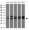 TNF Receptor Superfamily Member 10b antibody, TA807279S, Origene, Western Blot image 