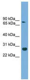 Homeobox protein CDX-1 antibody, TA342254, Origene, Western Blot image 