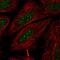 Ring Finger Protein 41 antibody, HPA016812, Atlas Antibodies, Immunocytochemistry image 
