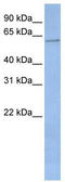 Cytochrome P450 Family 2 Subfamily C Member 19 antibody, TA346224, Origene, Western Blot image 