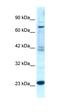 Regulator Of G Protein Signaling 10 antibody, orb331569, Biorbyt, Western Blot image 